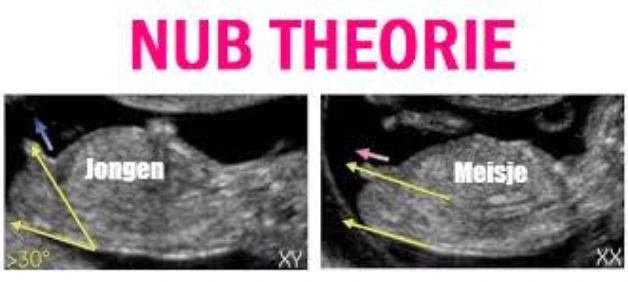 hub theorie jongen of meisje